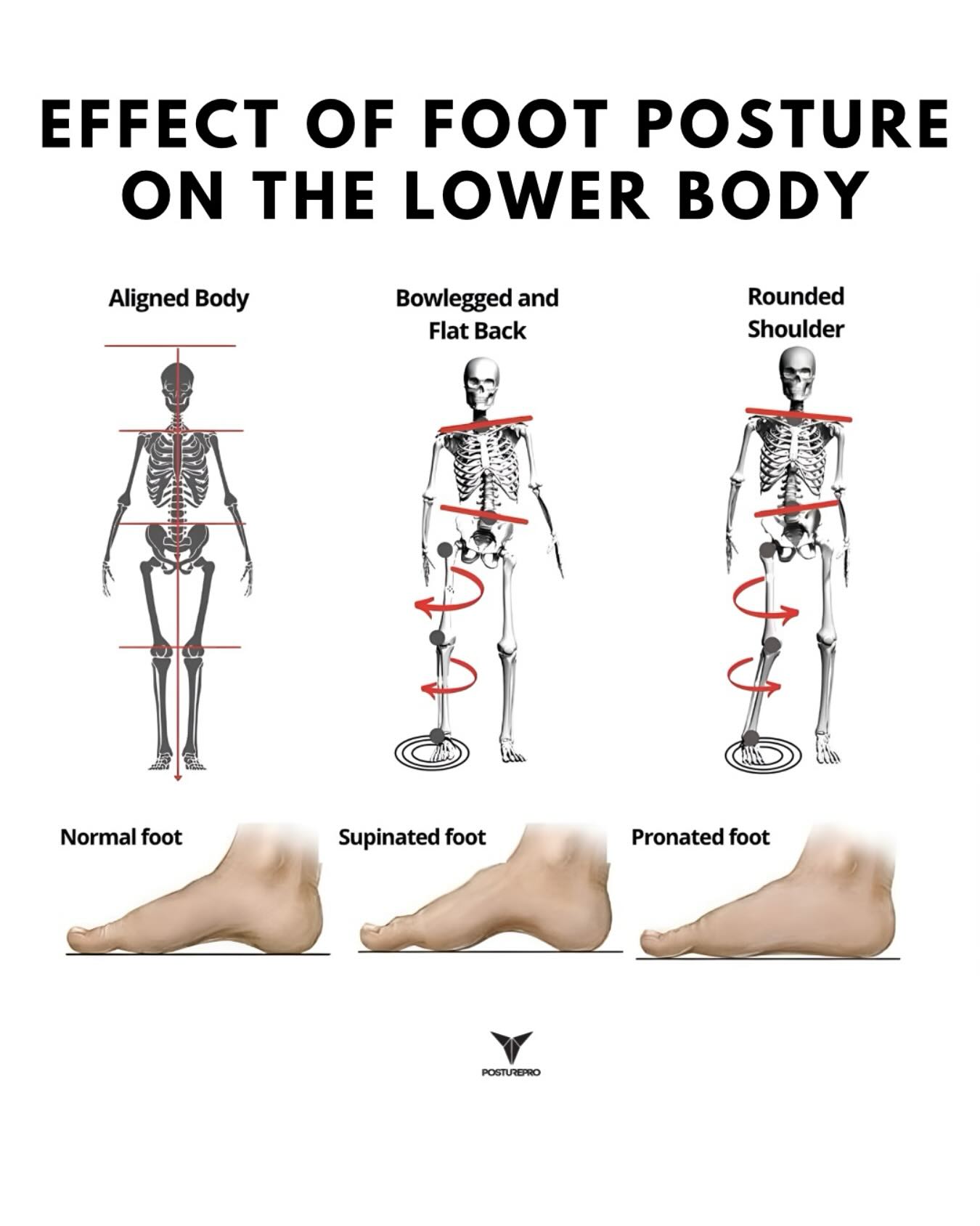 Picioarele – fundația corpului și importanța lor în echilibrul postural