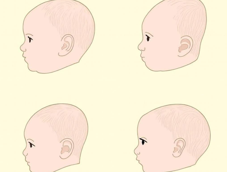 Forma capului bebelușului: când este cazul să ne îngrijorăm și cum poate ajuta osteopatia